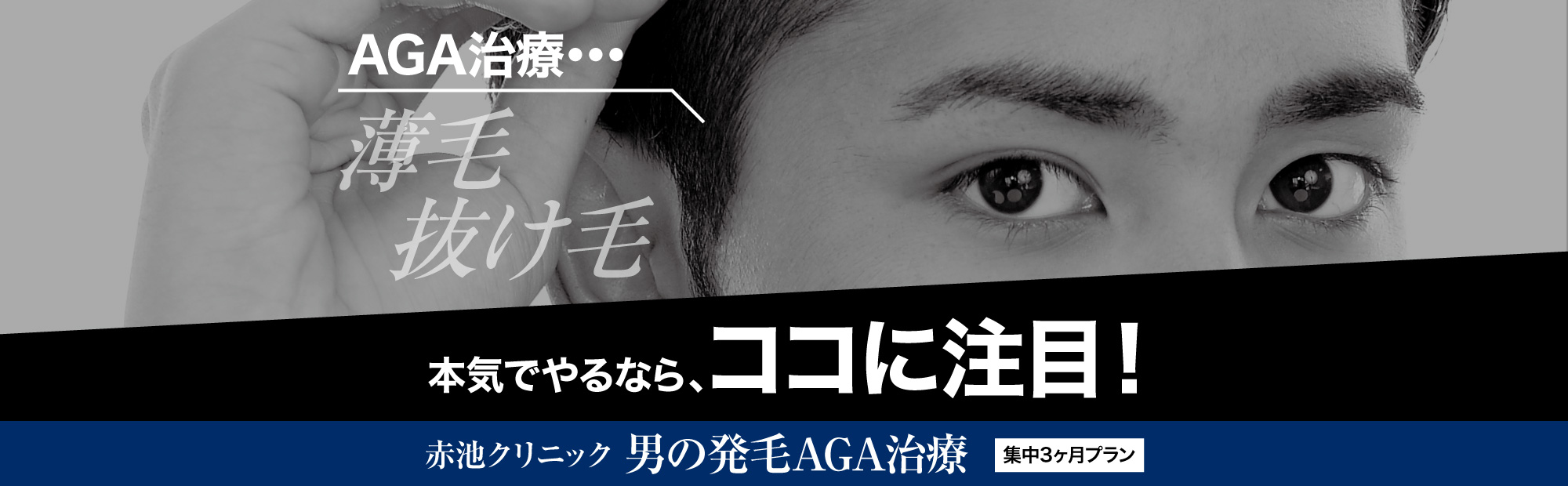 徳島のAGA・薄毛治療